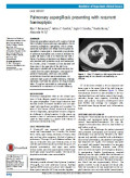 Pulmonary aspergillosis presenting with recurrent haemoptysis