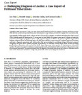 A Challenging Diagnosis of Ascites: A Case Report of Peritoneal Tuberculosis