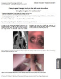 Oesophageal foreign body in the left main bronchus