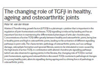 The changing role of TGFβ in healthy, ageing and osteoarthritic joints