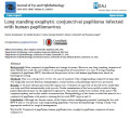 Long standing exophytic conjunctival papilloma infected with human papillomavirus