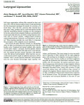 Laryngeal Liposuction