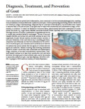 Diagnosis, Treatment, and Prevention of Gout