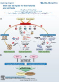 Stem cell therapies for liver failures and cirrhosis