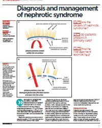 Image of Diagnosis and management of nephrotic syndrome