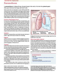 Image of Tuberculous meningitis: Diagnostic and therapeutic challenges