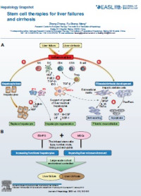 Image of Stem cell therapies for liver failures and cirrhosis