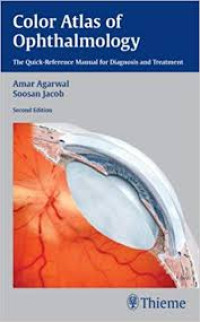 Image of Color Atlas of Ophthalmology : The Quick-Reference Manual for Diagnosis and Treatment